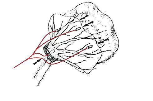 137938bc-eccd-4d8a-90d1-4be97da0b459-Windwurftellern.png